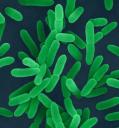 ypestis.jpg